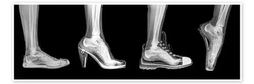 Diferentes zapatos, radiografía Science Photo Library