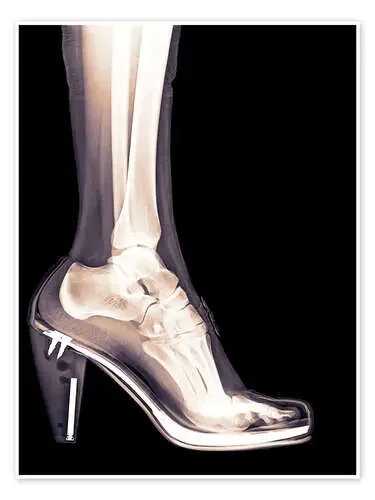 high heel shoe X-ray Science Photo Library