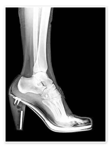 radioheels Science Photo Library
